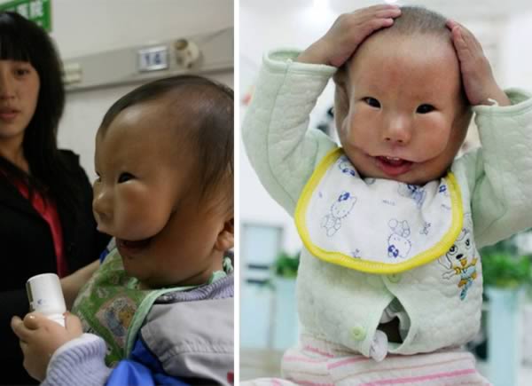 baby with 2 faces