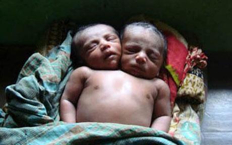 baby with 2 heads